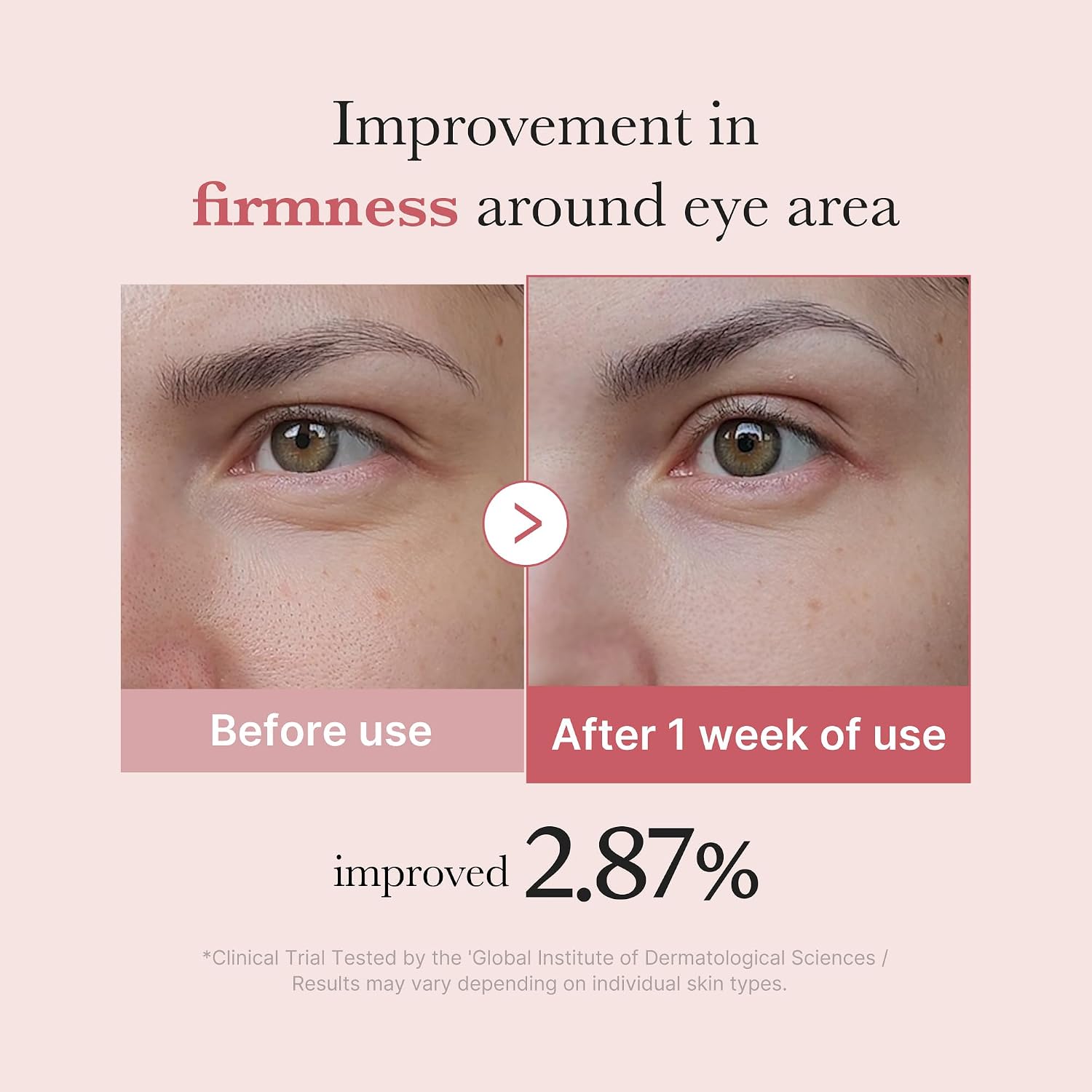 Radiant Eyes Cream